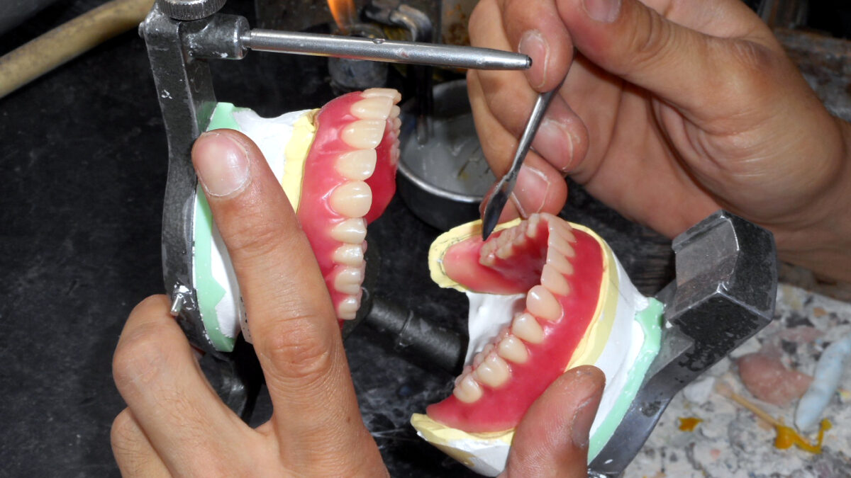 歯科技工士の業務（デンチャー）