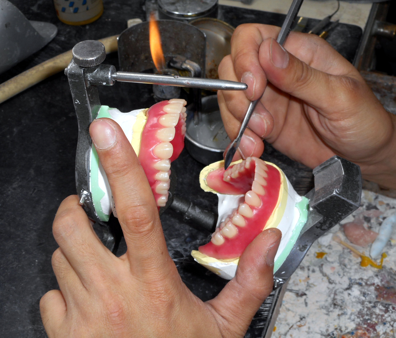歯科 技工 士 の 現状