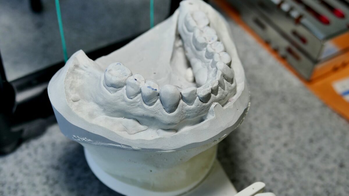 歯科技工　模型の画像