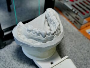 歯科技工　模型の画像