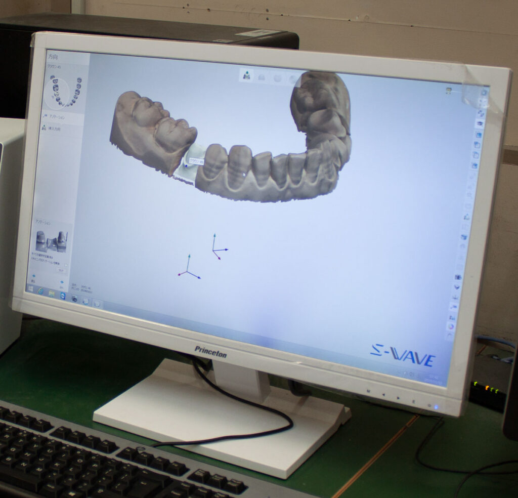 歯科技工士 CADCAMイメージ画像